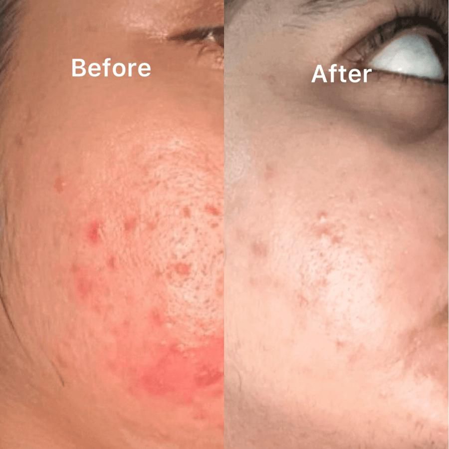 The Ordinary - Hyaluronic Facewash Of 100ml